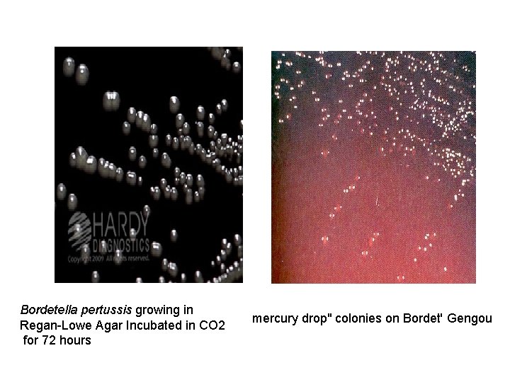 Bordetella pertussis growing in Regan-Lowe Agar Incubated in CO 2 for 72 hours mercury
