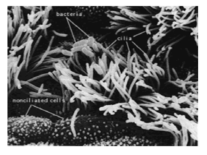 Diagnostic microbiology lecture 15 Bordetella pertussis Abed El