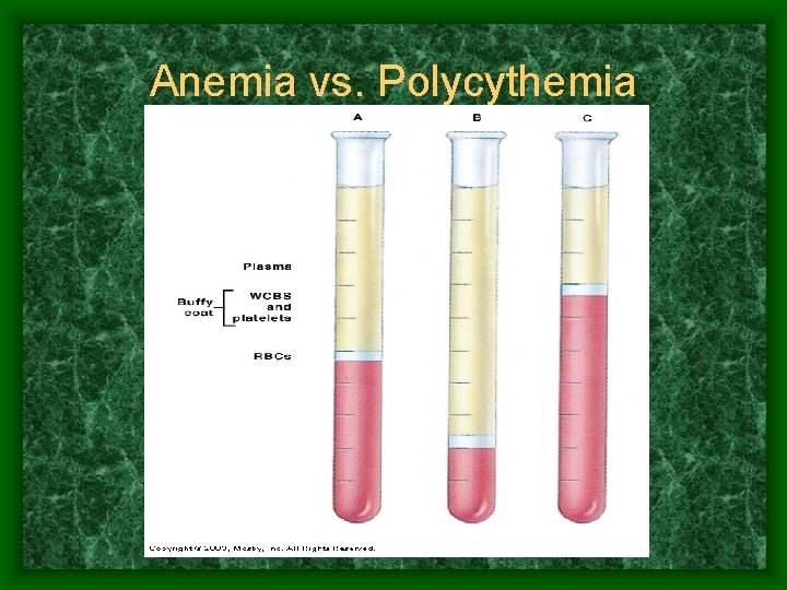 Anemia vs. Polycythemia 