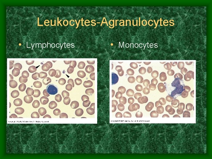 Leukocytes-Agranulocytes • Lymphocytes • Monocytes 