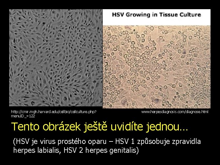 http: //cmir. mgh. harvard. edu/cellbio/cellculture. php? menu. ID_=122 www. herpesdiagnosis. com/diagnose. html Tento obrázek