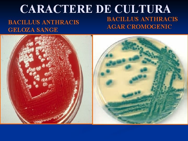 CARACTERE DE CULTURA BACILLUS ANTHRACIS GELOZA SANGE BACILLUS ANTHRACIS AGAR CROMOGENIC 