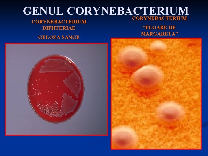 GENUL CORYNEBACTERIUM DIPHTERIAE GELOZA SANGE “FLOARE DE MARGARETA” 