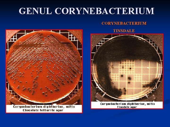 GENUL CORYNEBACTERIUM TINSDALE 