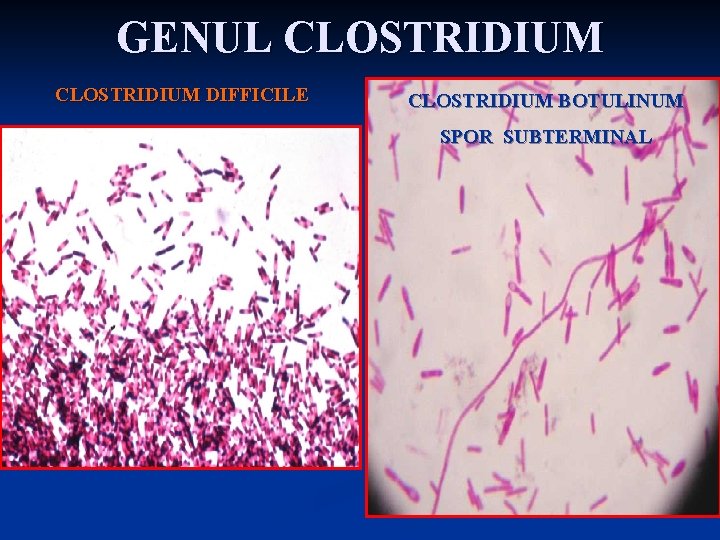 GENUL CLOSTRIDIUM DIFFICILE CLOSTRIDIUM BOTULINUM SPOR SUBTERMINAL 