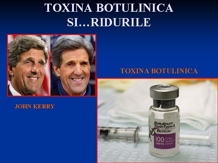 TOXINA BOTULINICA SI…RIDURILE TOXINA BOTULINICA JOHN KERRY 