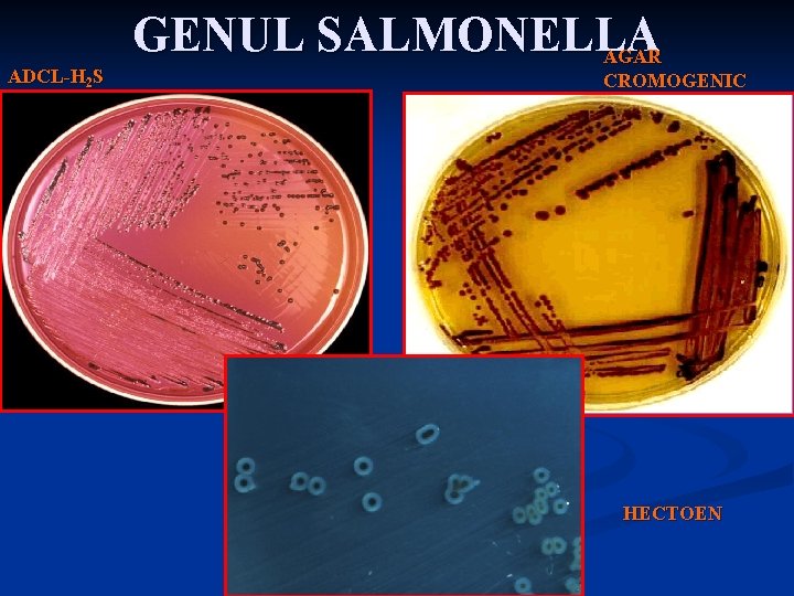 ADCL-H 2 S GENUL SALMONELLA AGAR CROMOGENIC HECTOEN 