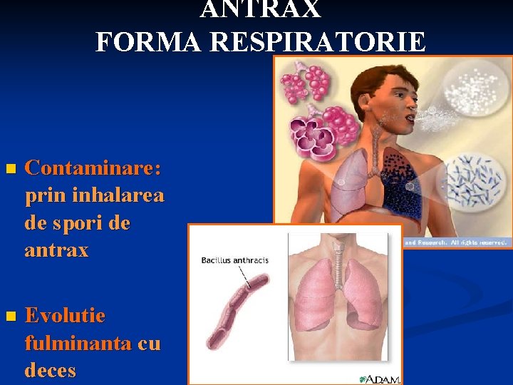 ANTRAX FORMA RESPIRATORIE n Contaminare: prin inhalarea de spori de antrax n Evolutie fulminanta