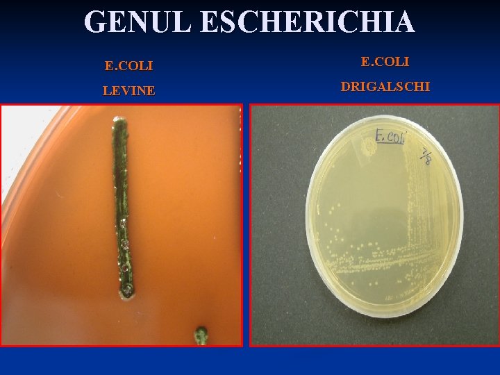 GENUL ESCHERICHIA E. COLI LEVINE DRIGALSCHI 