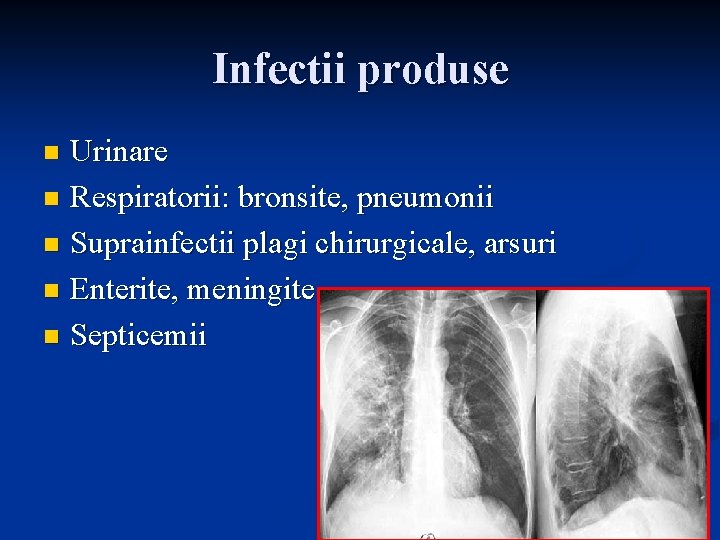 Infectii produse Urinare n Respiratorii: bronsite, pneumonii n Suprainfectii plagi chirurgicale, arsuri n Enterite,