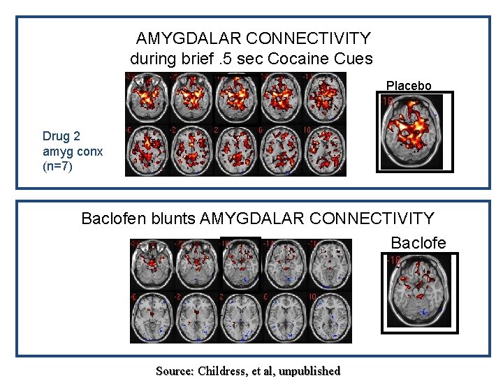 AMYGDALAR CONNECTIVITY during brief. 5 sec Cocaine Cues Placebo Drug 2 amyg conx (n=7)