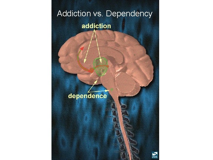 Addiction vs. Dependency 