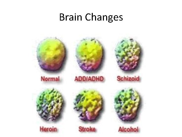 Brain Changes 