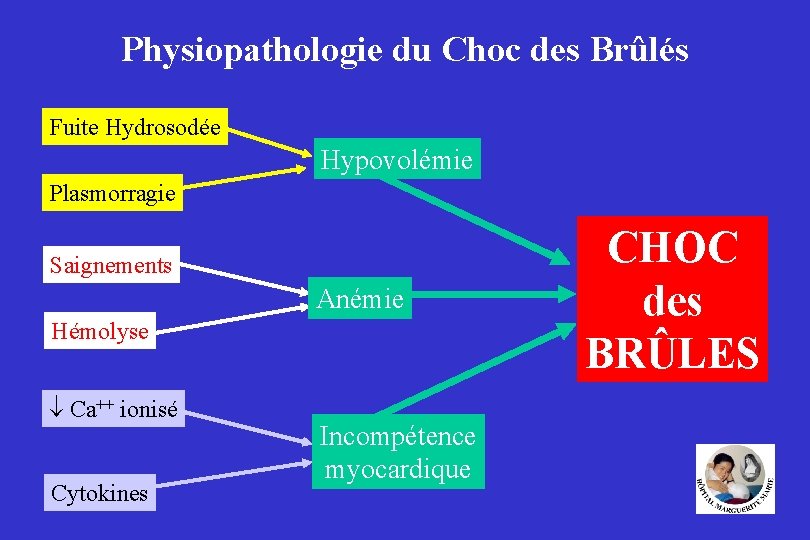 Physiopathologie du Choc des Brûlés Fuite Hydrosodée Hypovolémie Plasmorragie Saignements Anémie Hémolyse Ca++ ionisé