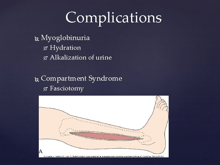 Complications Myoglobinuria Hydration Alkalization of urine Compartment Syndrome Fasciotomy 