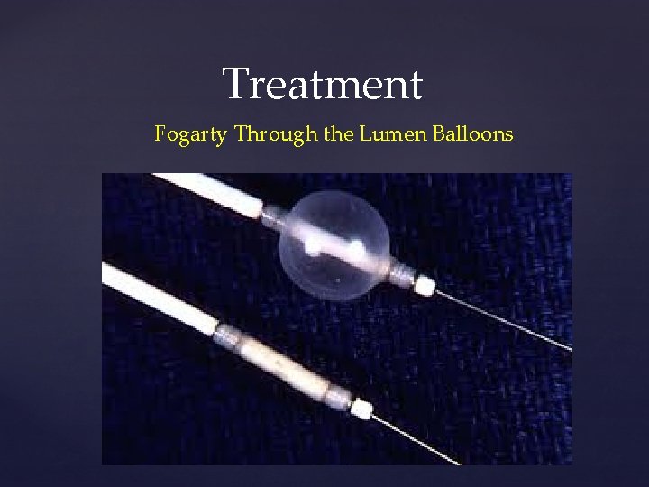Treatment Fogarty Through the Lumen Balloons 