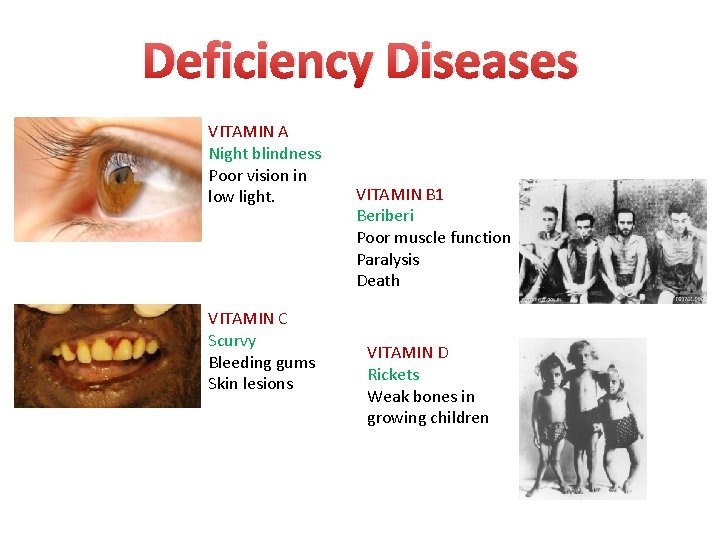 Deficiency Diseases VITAMIN A Night blindness Poor vision in low light. VITAMIN C Scurvy