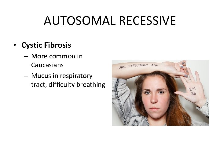 AUTOSOMAL RECESSIVE • Cystic Fibrosis – More common in Caucasians – Mucus in respiratory