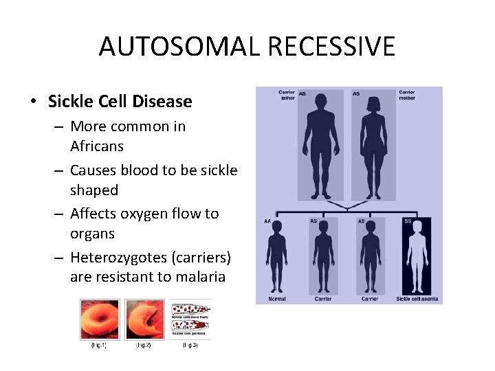 AUTOSOMAL RECESSIVE • Sickle Cell Disease – More common in Africans – Causes blood