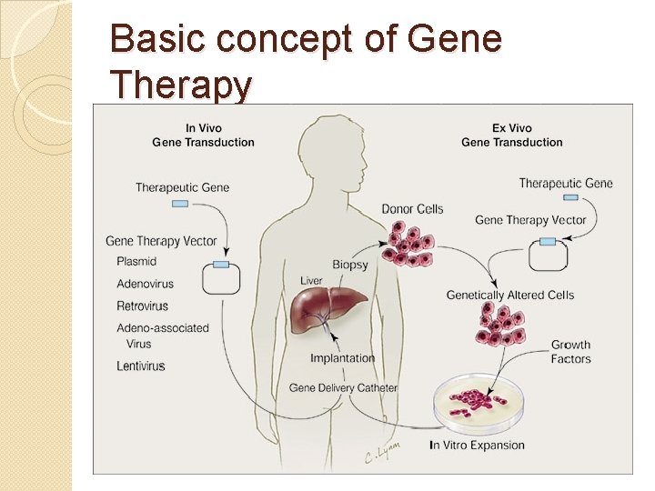 Basic concept of Gene Therapy 