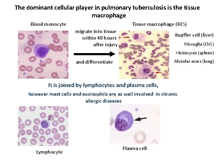 The dominant cellular player in pulmonary tuberculosis is the tissue macrophage Blood monocyte Tissue