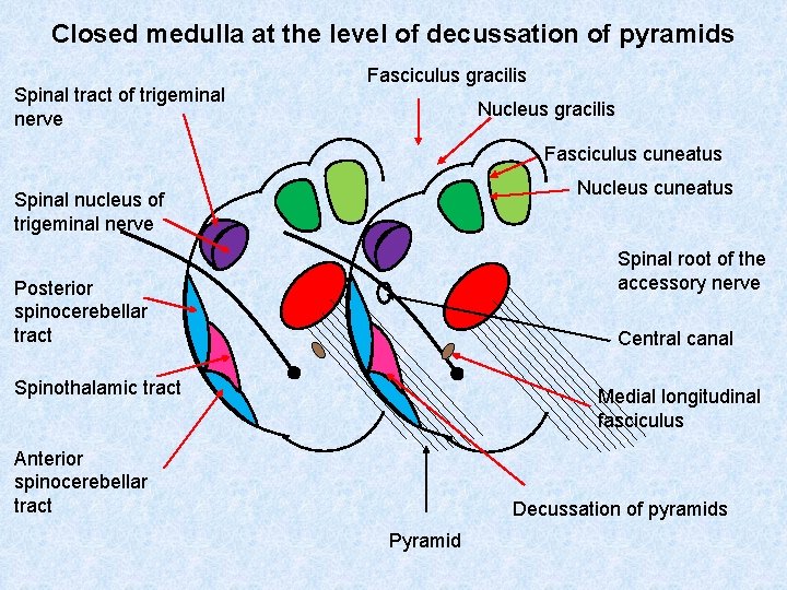 Closed medulla at the level of decussation of pyramids Spinal tract of trigeminal nerve