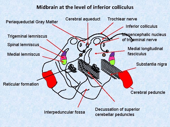 Midbrain at the level of inferior colliculus Periaqueductal Gray Matter Cerebral aqueduct Trigeminal lemniscus