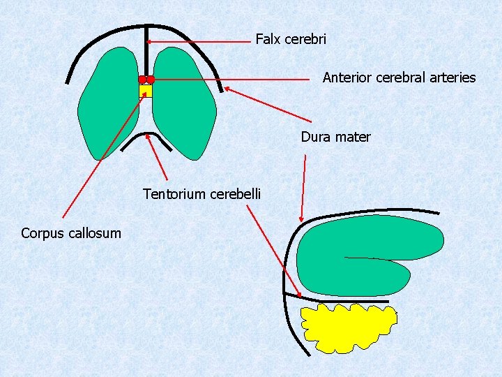 Falx cerebri Anterior cerebral arteries Dura mater Tentorium cerebelli Corpus callosum 
