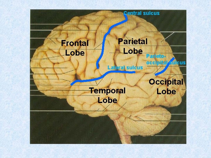 Central sulcus Frontal Lobe Parieto. Lateral sulcus Temporal Lobe occipital sulcus Occipital Lobe 