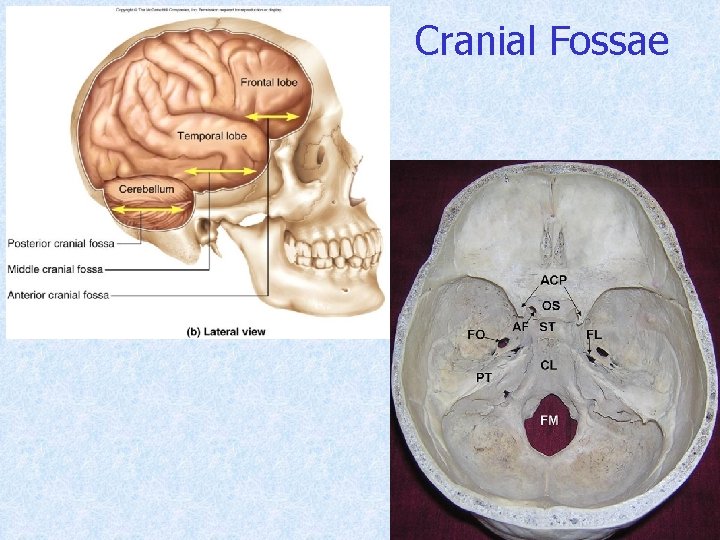Cranial Fossae 