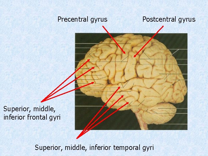 Precentral gyrus Postcentral gyrus Superior, middle, inferior frontal gyri Superior, middle, inferior temporal gyri