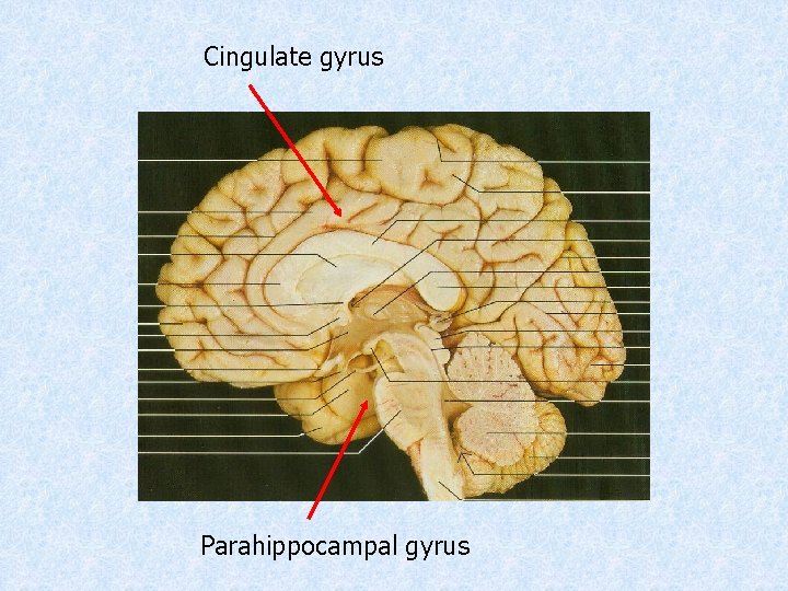 Cingulate gyrus Parahippocampal gyrus 