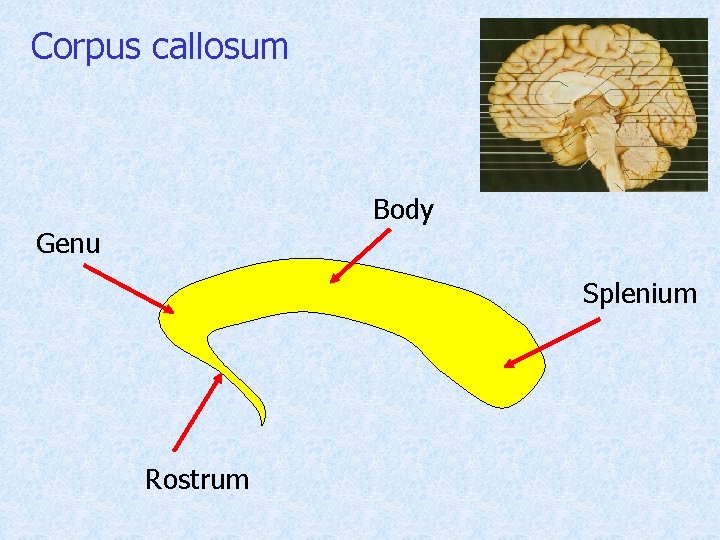 Corpus callosum Body Genu Splenium Rostrum 