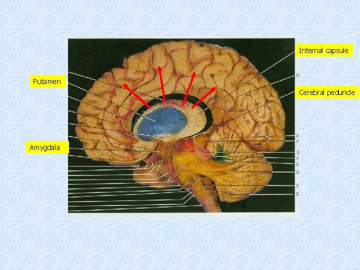 Internal capsule Putamen Cerebral peduncle Amygdala 
