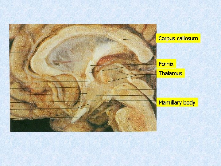 Corpus callosum Fornix Thalamus Mamillary body 