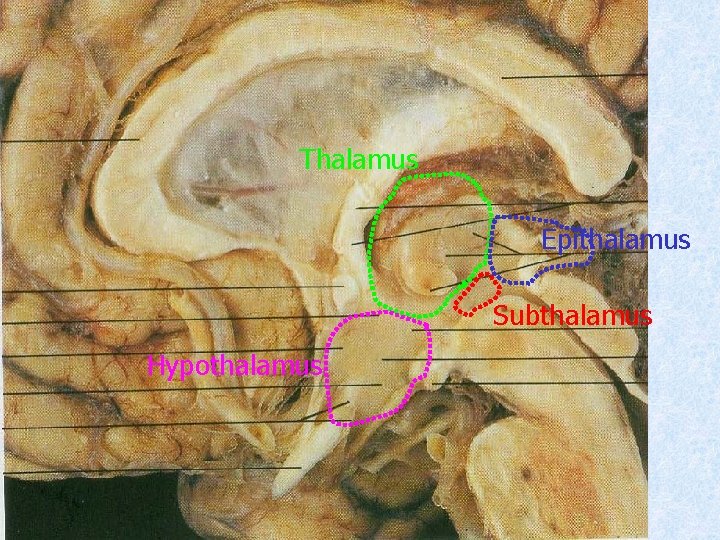 Thalamus Epithalamus Subthalamus Hypothalamus 