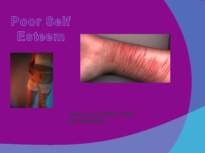 Poor Self Esteem Teen Link Help Line: 866. TEENLINK 