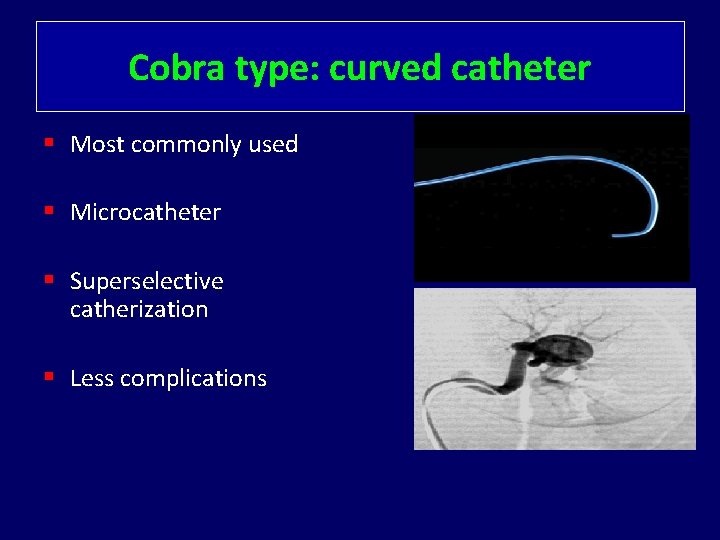 Cobra type: curved catheter § Most commonly used § Microcatheter § Superselective catherization §