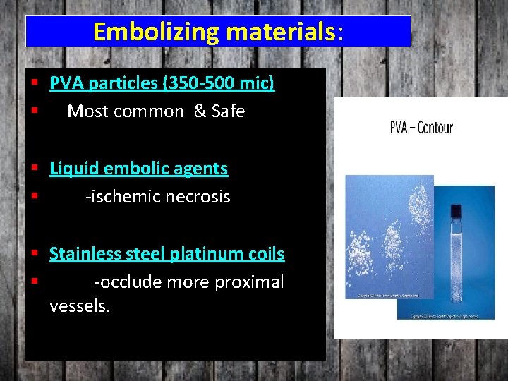 Embolizing materials: § PVA particles (350 -500 mic) § Most common & Safe §