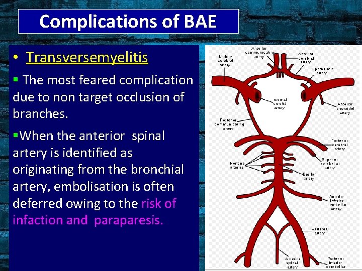 Complications of BAE • Transversemyelitis § The most feared complication due to non target