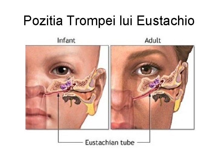 Pozitia Trompei lui Eustachio 