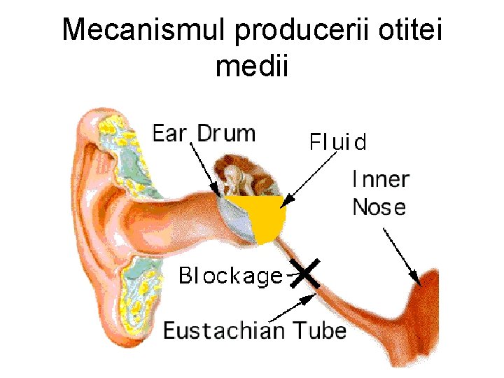 Mecanismul producerii otitei medii 