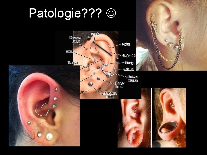 Patologie? ? ? 