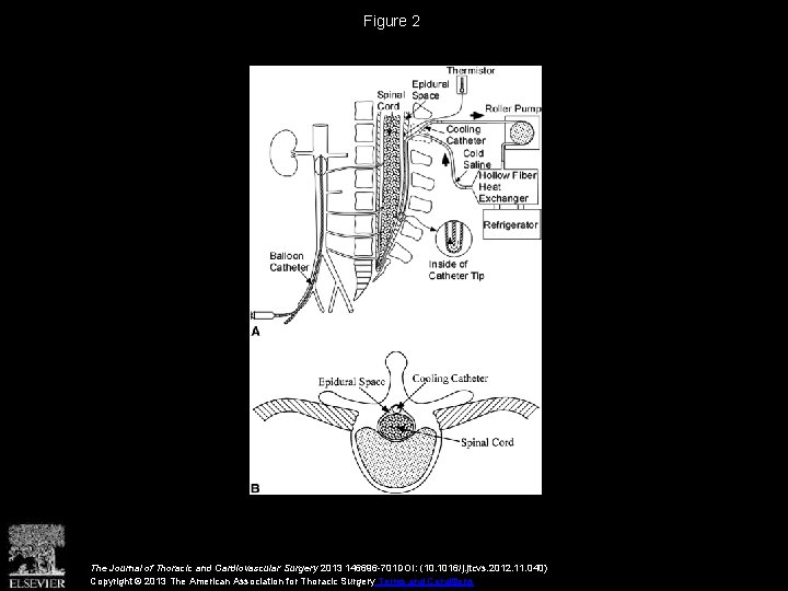 Figure 2 The Journal of Thoracic and Cardiovascular Surgery 2013 146696 -701 DOI: (10.