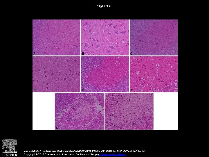 Figure 5 The Journal of Thoracic and Cardiovascular Surgery 2013 146696 -701 DOI: (10.