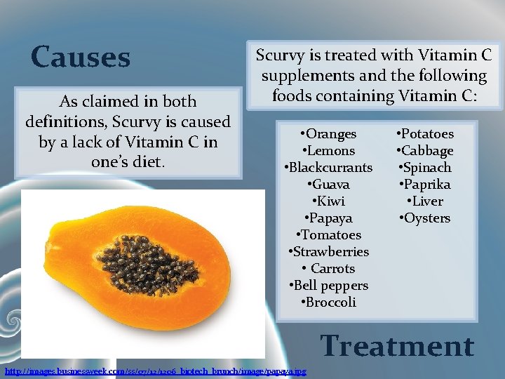 Causes As claimed in both definitions, Scurvy is caused by a lack of Vitamin