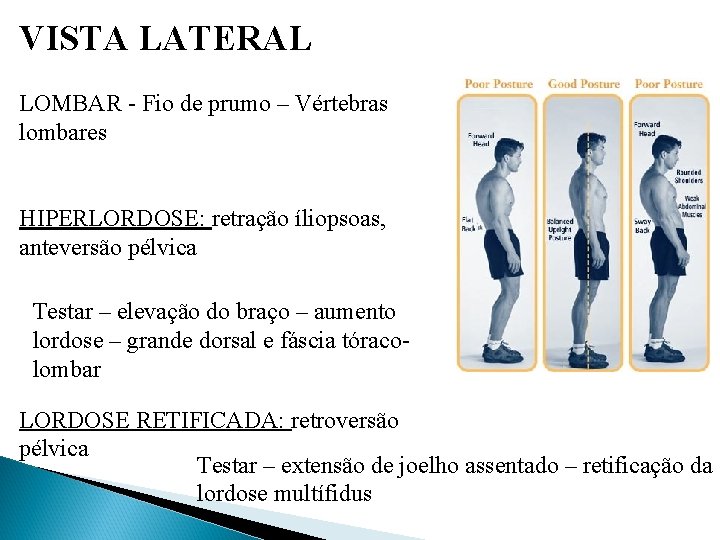 VISTA LATERAL LOMBAR - Fio de prumo – Vértebras lombares HIPERLORDOSE: retração íliopsoas, anteversão