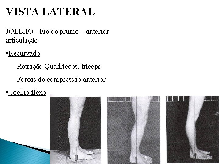 VISTA LATERAL JOELHO - Fio de prumo – anterior articulação • Recurvado Retração Quadríceps,