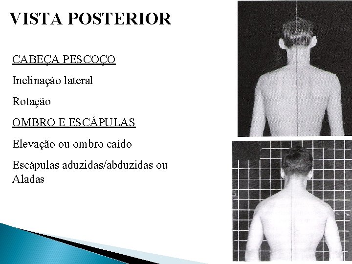 VISTA POSTERIOR CABEÇA PESCOÇO Inclinação lateral Rotação OMBRO E ESCÁPULAS Elevação ou ombro caído