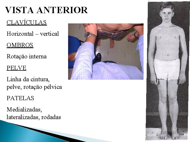 VISTA ANTERIOR CLAVÍCULAS Horizontal – vertical OMBROS Rotação interna PELVE Linha da cintura, pelve,